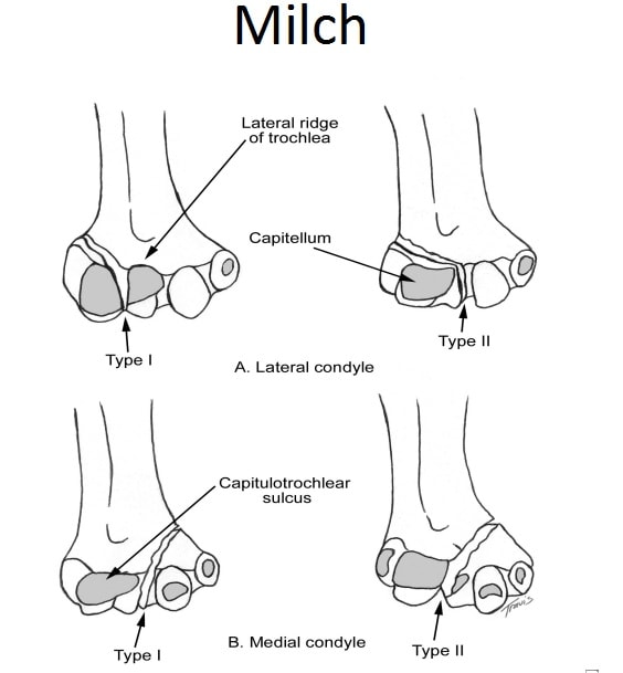 Classificação de Milch