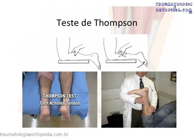 thompson2