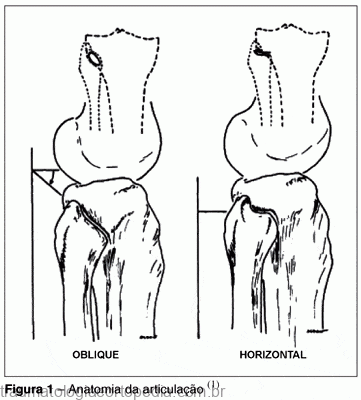 articulação tibiofibular proximal