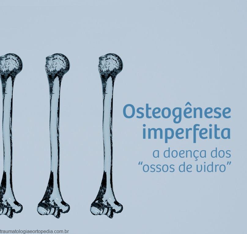 osteogenese imperfeita doença ossos de vidro