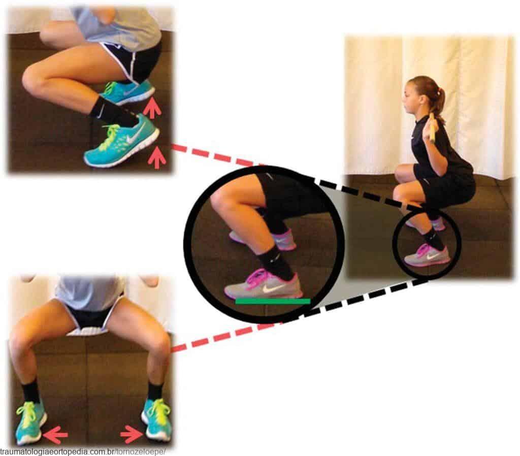 mobilidade de pes e tornozelos