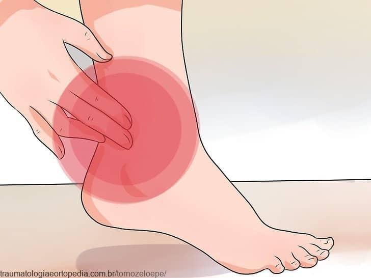 Tratamento para tendinites no tornozelo e pé