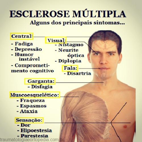 sintomas da esclerose multipla